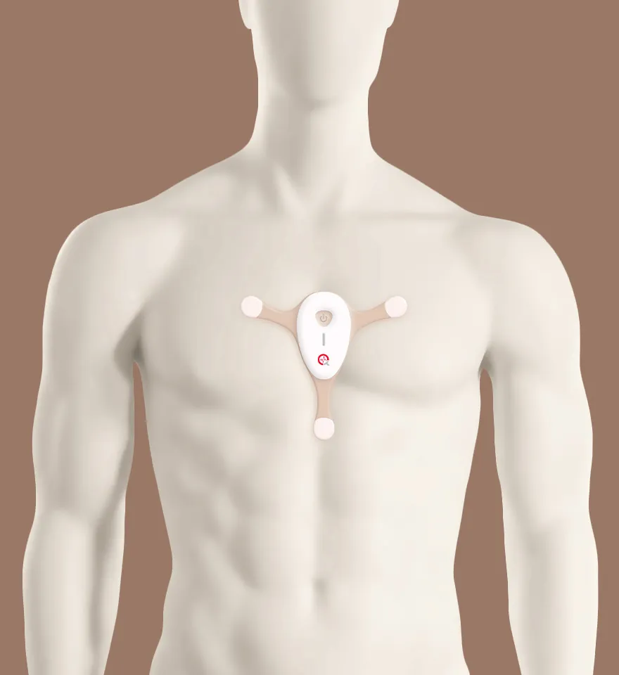 holter 24 horas